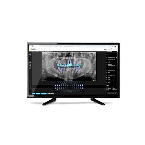 Программное обеспечение для анализа - AI Insights - Carestream Dental - для диагностики / для составления отчетности / для анализа изображений