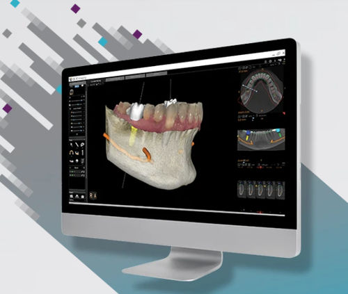 Программное обеспечение для визуализации - CS 3D - Carestream Dental - для анализа / для управления данными пациента / для диагностики
