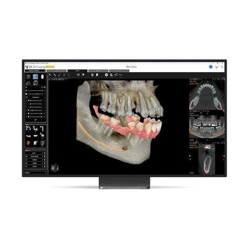 Клиническое программное обеспечение - CS 3D Imaging Premium - Carestream Dental - для стоматологии / для стоматологической имплантологии / для стоматологической хирургии