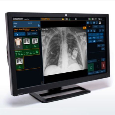 Программное обеспечение для медицинских снимков - ImageView - Carestream - для анализа / для контроля / контроля инфекций
