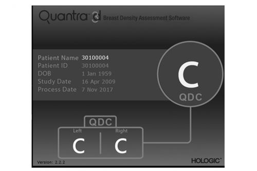 Программное обеспечение для маммографии - Quantra™ - Hologic - медицинское / для составления отчетности / CAO