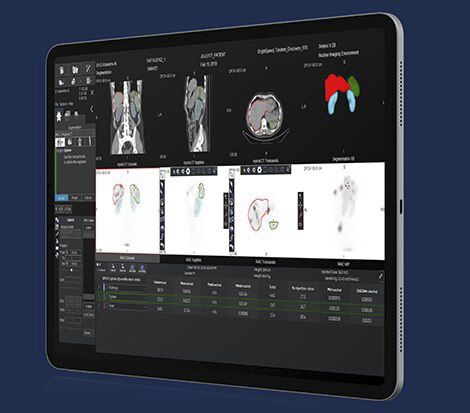 Приложение android для связи - Xeleris V - GE Healthcare - для измерений / для анализа / для медицинской радиологии