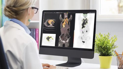 Программное обеспечение для обработки - MIM™ - GE Healthcare - для планирования / для планирования лечения / медицинское