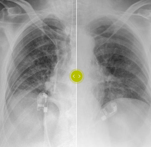 Алгоритм для приобретения - SkyFlow Plus - Philips Healthcare - для симуляции / для машинного обучения / рентгенографии