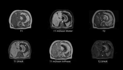 Программное обеспечение для симуляции - 4D MR-RT - Philips Healthcare - для контурной обработки / для планирования лечения / медицинское