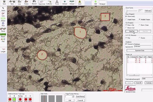 Медицинское программное обеспечение - LMD   - Leica Microsystems - для лабораторий / для цифровых микроскопов / для анализа
