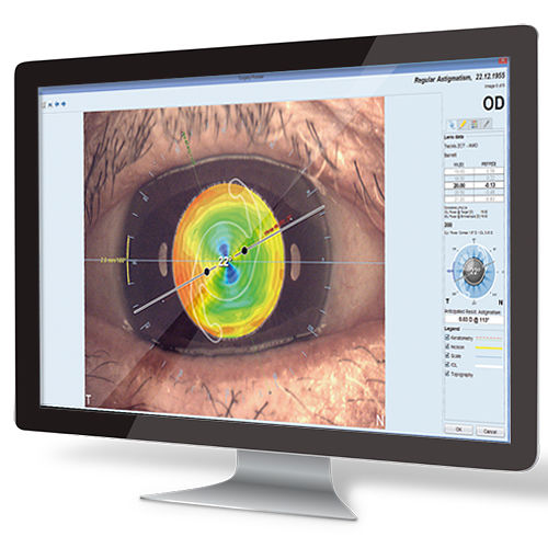Программное обеспечение для планирования - EyeSuite IOL  - Haag-Streit Diagnostics - для измерений / для офтальмологической хирургии / анатомическое