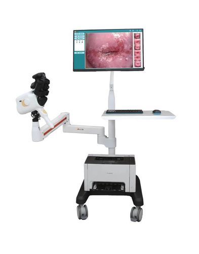 Цифровой кольпоскоп - V1-V2 - Guangzhou Sunray Medical Equipment Co., Ltd. - на тележке
