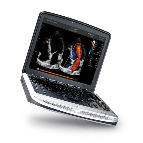 Переносной ультразвуковой сканер - SonoBook 8 - CHISON Medical Technologies - для поливалентной эхографии / черно-белый / цветовой допплер