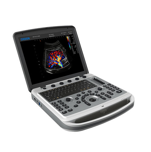 Переносной ветеринарный ультразвуковой сканер - SonoBook 6 - CHISON Medical Technologies - многоцелевой / черно-белый / цветовой допплер