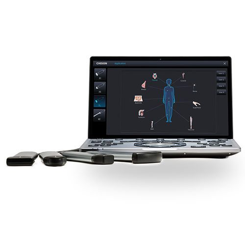 Переносной ультразвуковой сканер - SonoAir 60 - CHISON Medical Technologies - для поливалентной эхографии / черно-белый / управление иглой
