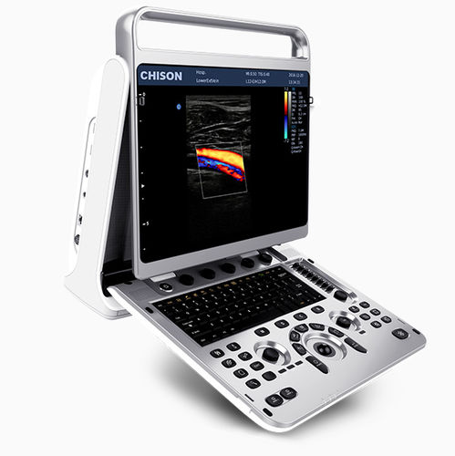Переносной ультразвуковой сканер - EBit 20 - CHISON Medical Technologies - для поливалентной эхографии / для эхографии в акушерстве и гинекологии / для брюшной и тазовой эхографии