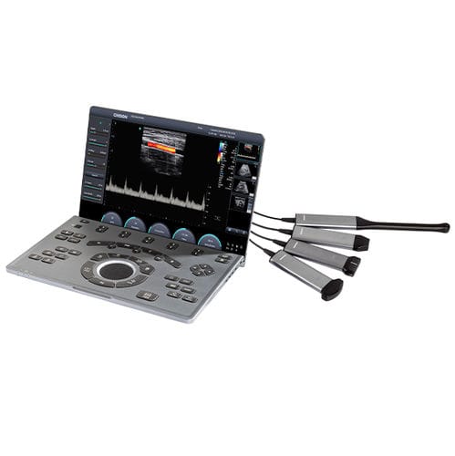 Переносной ультразвуковой сканер - SonoAir 30 - CHISON Medical Technologies - для поливалентной эхографии / для эхографии в акушерстве и гинекологии / для сердечно-сосудистой эхографии