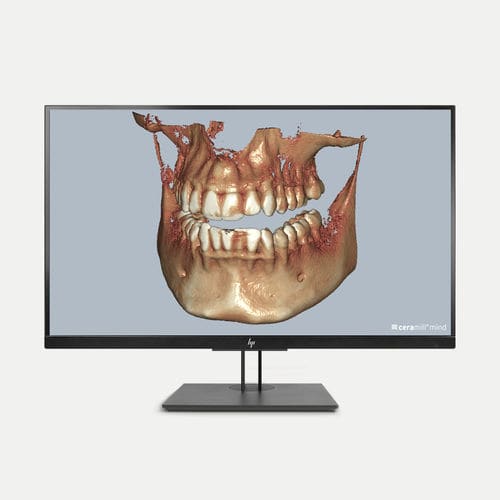 Модуль программного обеспечения для визуализации DICOM - Ceramill Dicom-Viewer - Amann Girrbach - для диагностики / для контроля / CAO