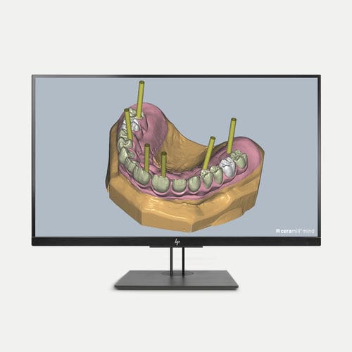 Модуль программного обеспечения для стоматологической имплантологии - Ceramill M-Gin - Amann Girrbach - CAO