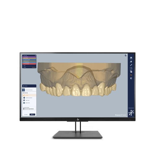 Программное обеспечение для лабораторий - Ceramill Mind - Amann Girrbach - для стоматологии / CAO / для проектирования зубных протезов