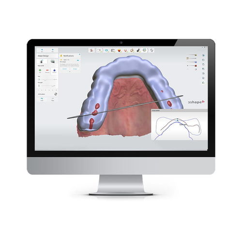 Программное обеспечение для контроля - SPLINT STUDIO - 3shape - для стоматологии / ортодонтическое / для обработки