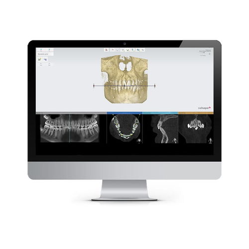 Программное обеспечение для планирования лечения - Ortho Planner - 3shape - клиническое / ортодонтическое / для анализа