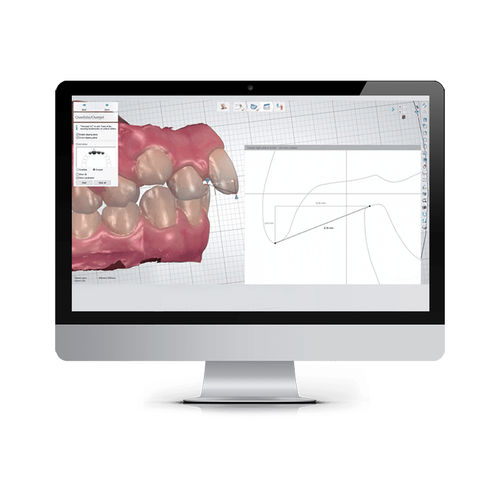 Ортодонтическое программное обеспечение - ALIGNER STUDIO - 3shape - для анализа / для управления / для планирования лечения