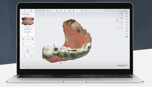 Клиническое программное обеспечение - Implant Studio™ - 3shape - для стоматологической имплантологии / для стоматологических кабинетов / хирургическое