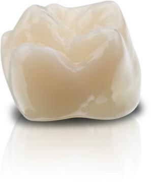 Гибридный стоматологический материал - VarseoSmile&reg; Crown plus - BEGO - из гибридной керамики / из полимера / для зубных коронок