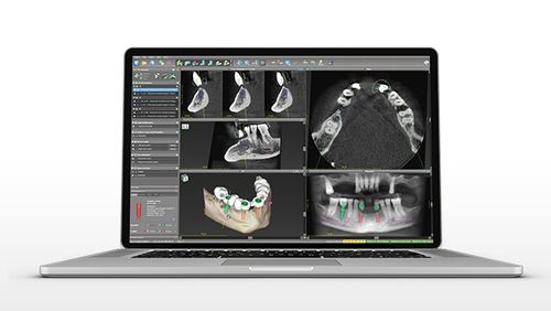 Программное обеспечение для планирования - coDiagnostiX - Dental Wings   - для разработки / для стоматологической хирургии / для стоматологии