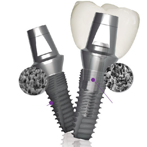 Конический зубной имплантат - Implantium II  - Dentium - из титана / внутренний шестиугольник