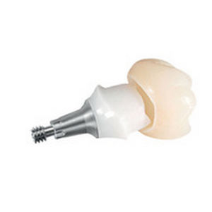 Абатмент из титана - ANKYLOS® TitaniumBase - DENTSPLY Implants GmbH - внутренний / прямой