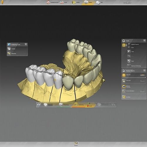 Программное обеспечение для стоматологических лабoраторий - inLab  - DENTSPLY MAILLEFER - для стоматологической имплантологии / для восстановления зубов / для разработки