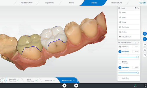 Программное обеспечение для стоматологических лабoраторий - CEREC - DENTSPLY MAILLEFER - ортодонтическое / для анализа / для мониторинга