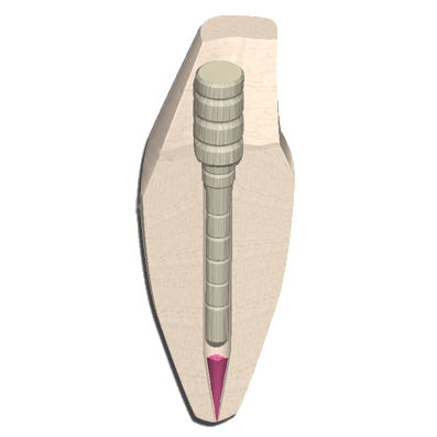 Корневой штифт из волокон - EZ-Fit&reg; Fiber - ESSENTIAL DENTAL SYSTEMS  