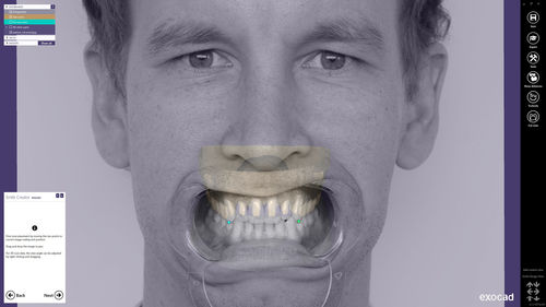 Программное обеспечение для анализа - Smile Creator - exocad GmbH   - для планирования / для разработки / CAO