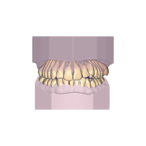 Модуль программного обеспечения для разработки - Ortho - exocad GmbH   - для моделирования / для архивирования / ортодонтический
