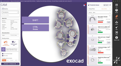Медицинское программное обеспечение - exocam - exocad GmbH   - для стоматологических лабoраторий / для управления данными / для визуализации