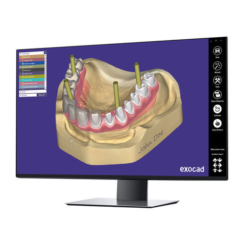 Модуль программного обеспечения для разработки - Implant  - exocad GmbH   - CAO / для стоматологической имплантологии