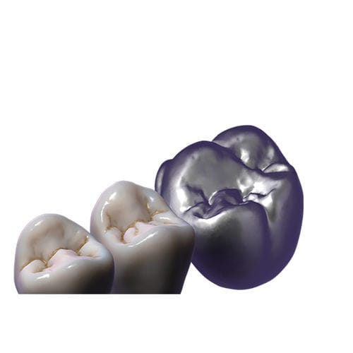 Модуль программного обеспечения для контроля - TruSmile  - exocad GmbH   - для разработки / CAO / для восстановления зубов