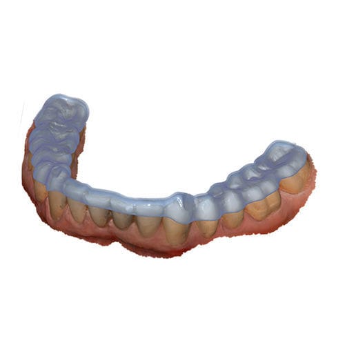 Модуль программного обеспечения для разработки - Bite Splint - exocad GmbH   - для стоматологии / сустава