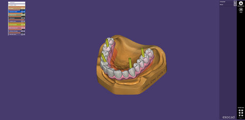 Веб-приложение для обмена информацией - webview - exocad GmbH   - для визуализации 3D / медицинское / для стоматологии