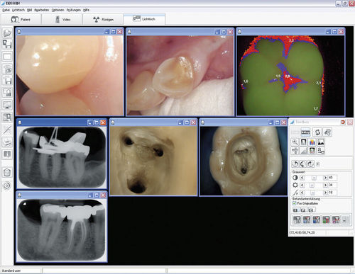 Программное обеспечение для визуализации - DBSWIN  - Dürr Dental - для диагностики / для планирования / для разработки