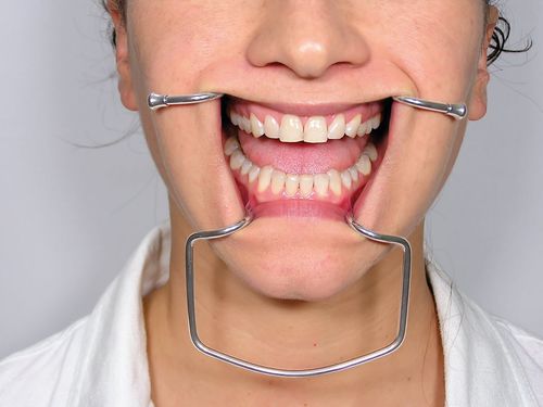 Расширитель для щек - CRO2 - Jakobi Dental GmbH - для стоматологии / для взрослых / из нержавеющей стали