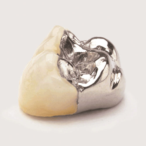 Стоматологический материал из фарфора - JPW - Jensen Dental   - для восстановления зубов / для зубных мостов / твердый