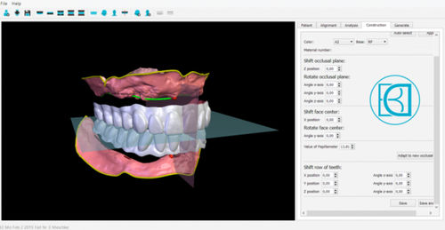 Программное обеспечение для анализа - BDCreator® - Merz Dental GmbH   - для контроля / для визуализации / для проектирования зубных протезов