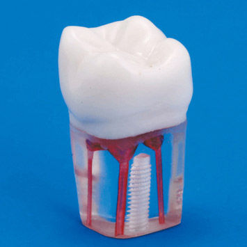 Анатомическая модель зубов - S12A-200 - Nissin Dental Products Inc.   - корневого канала / учебная / прозрачная
