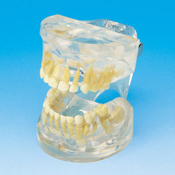 Анатомическая модель прорезывание зубов - PE-PDI001 - Nissin Dental Products Inc.   - для образовательных целей / ребенок / прозрачная
