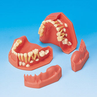Анатомическая модель прорезывание зубов - PE-PDI004 - Nissin Dental Products Inc.   - десен / для образовательных целей / ребенок