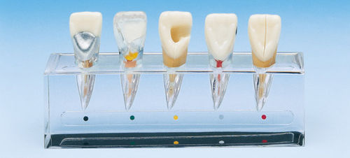 Анатомическая модель для стоматологии - PE-END001 - Nissin Dental Products Inc.   - корневого канала / эндодонтологическая / для образовательных целей
