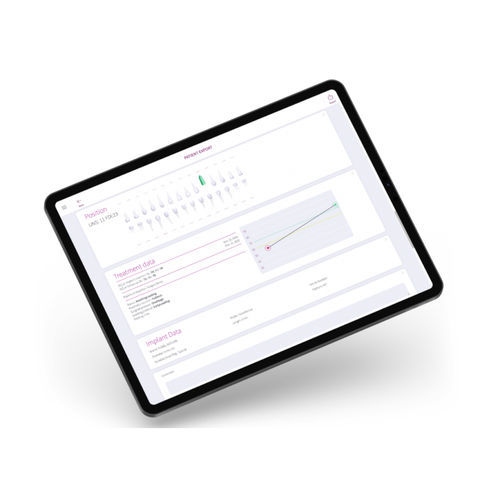 Веб-приложение для обработки - OSSTELL AB   - медицинское / клиническое / для стоматологии