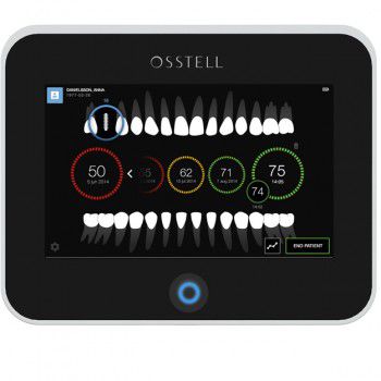 Прибор для измерения стабильности имплантантов с сенсорным экраном - Osstell IDx - OSSTELL AB  