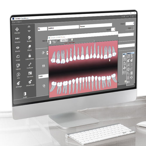 Программное обеспечение для контроля - Quickvision - Owandy Radiology - для визуализации / для диагностики / для приобретения