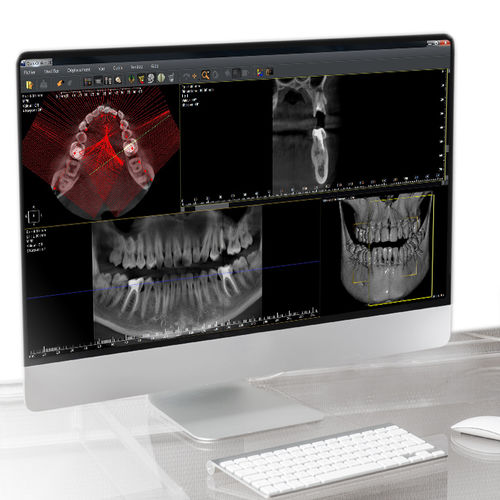 Программное обеспечение для анализа - QuickVision 3D - Owandy Radiology - для визуализации / для диагностики / для планирования